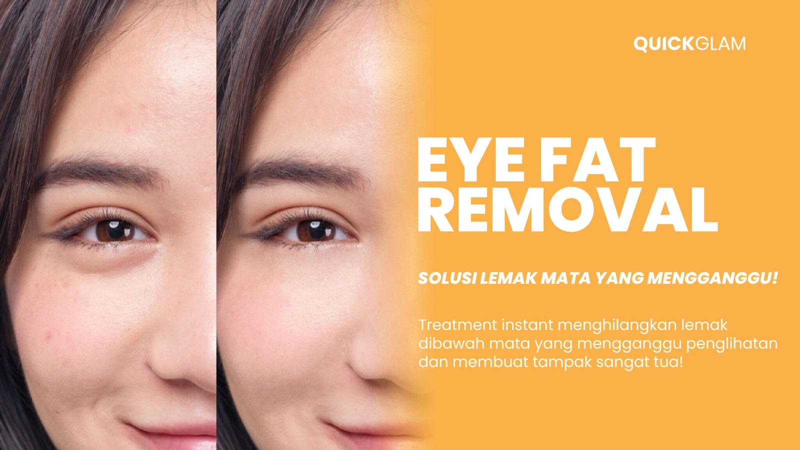 Display untuk layar ballroom-22